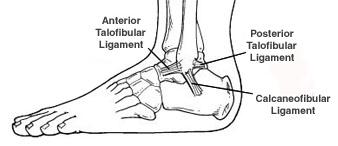 Ankle sprains, twisting ankle
